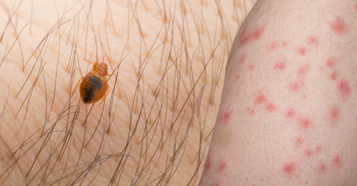 Bed Bug Bites How To Identify And Treatment Nj Pest Control